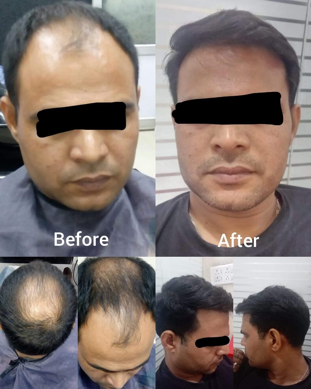 Sareen Hair Clinic - Hair Restoration Clinic in Greater Kailash Enclavei,  New Delhi, India 